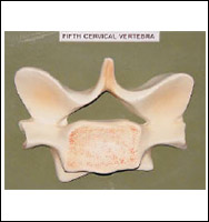 Cervical Vertebra